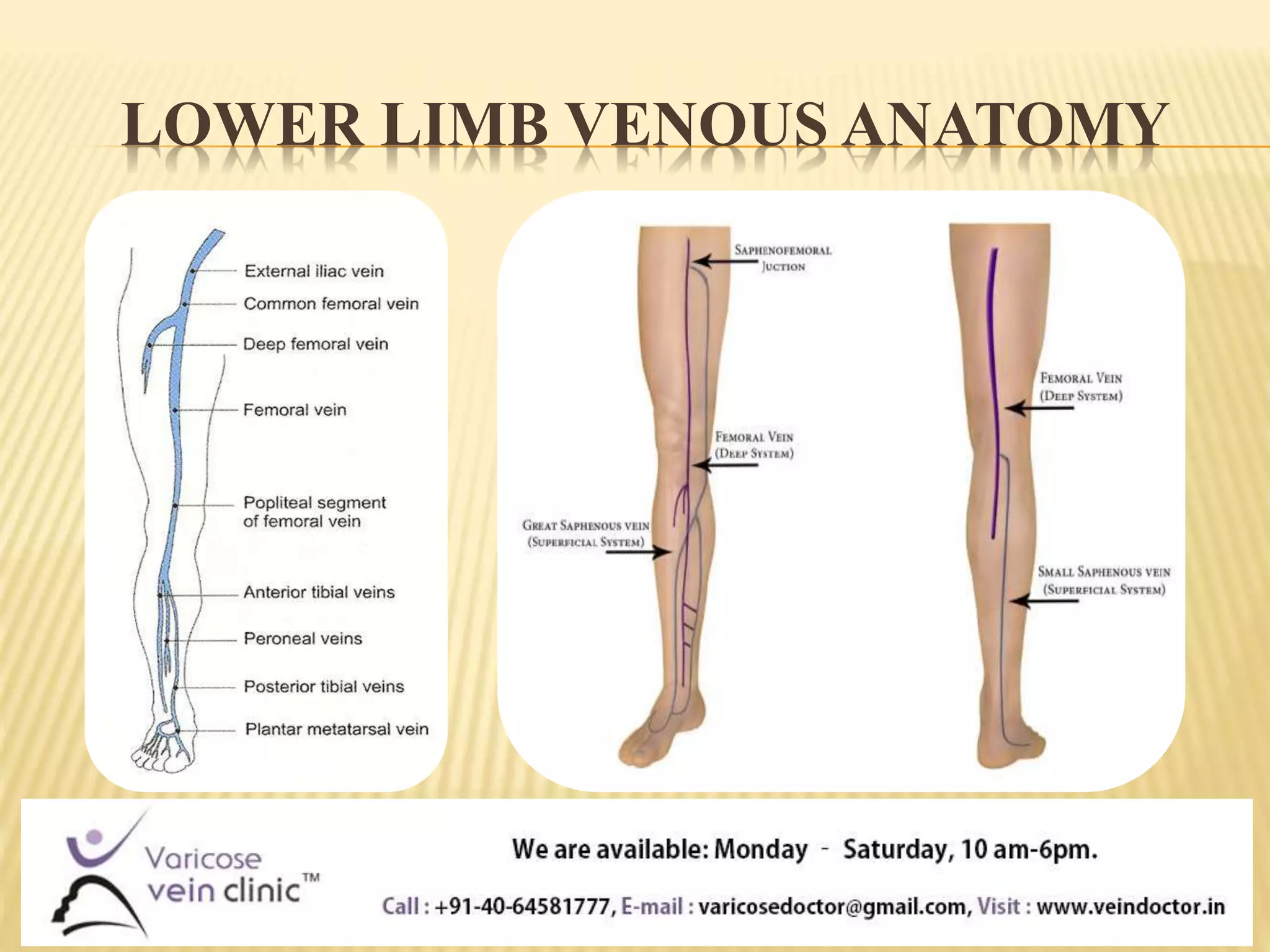 Know about varicose veins | Best Treatment for Varicose Veins | PPT