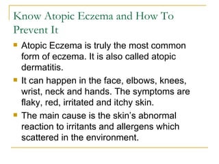 Know Atopic Eczema and How To Prevent It ,[object Object],[object Object],[object Object]
