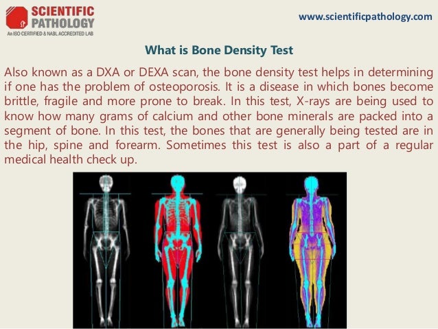 Know bone density test in details