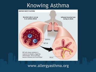 Knowing Asthma




www.allergyasthma.org
 