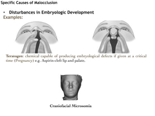 Known causes of Malocclusion | PDF