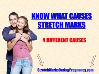 KNOW WHAT CAUSES
  STRETCH MARKS
   4 DIFFERENT CAUSES




 StretchMarksDuringPregnancy.com
 