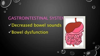 GASTROINTESTINAL SYSTEM
Decreased bowel sounds
Bowel dysfunction
 