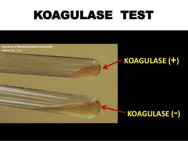 Koagulase test for S Au UNISBA Indonesia 