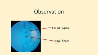 Observation
Fungal Hyphae
Fungal Spore
 