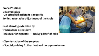 Prone Position:
Disadvantages
-Un-scrubbed assistant is required
for intraoperative adjustment of the table
-Not allowing extension by
trochanteric osteotomy
-Muscular or high BMI --- heavy posterior flap
-Disorientation of the surgeon
--Special padding fo the chest and bony prominence
 