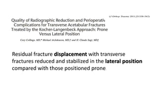 Residual fracture displacement with transverse
fractures reduced and stabilized in the lateral position
compared with those positioned prone.
 