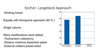 Kocher- Langebeck Approach
Working horse!
Equally with ilioinguinal approach (40 % )
Single column
Many modifications were added
-Trochanteric osteotomy
-Gluteus maximus dissection plane
-External rotators preservation
 