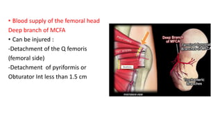 • Blood supply of the femoral head
Deep branch of MCFA
• Can be injured :
-Detachment of the Q femoris
(femoral side)
-Detachment of pyriformis or
Obturator Int less than 1.5 cm
 