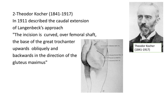 Kocher-Langenbeck acetabular approach | PPTX