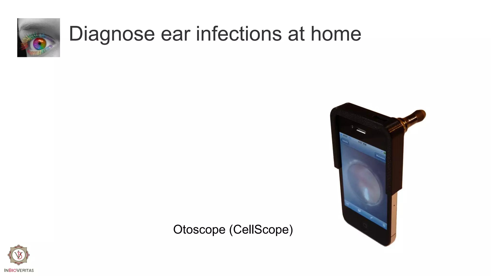 Diagnose ear infections at home

Otoscope (CellScope)

 