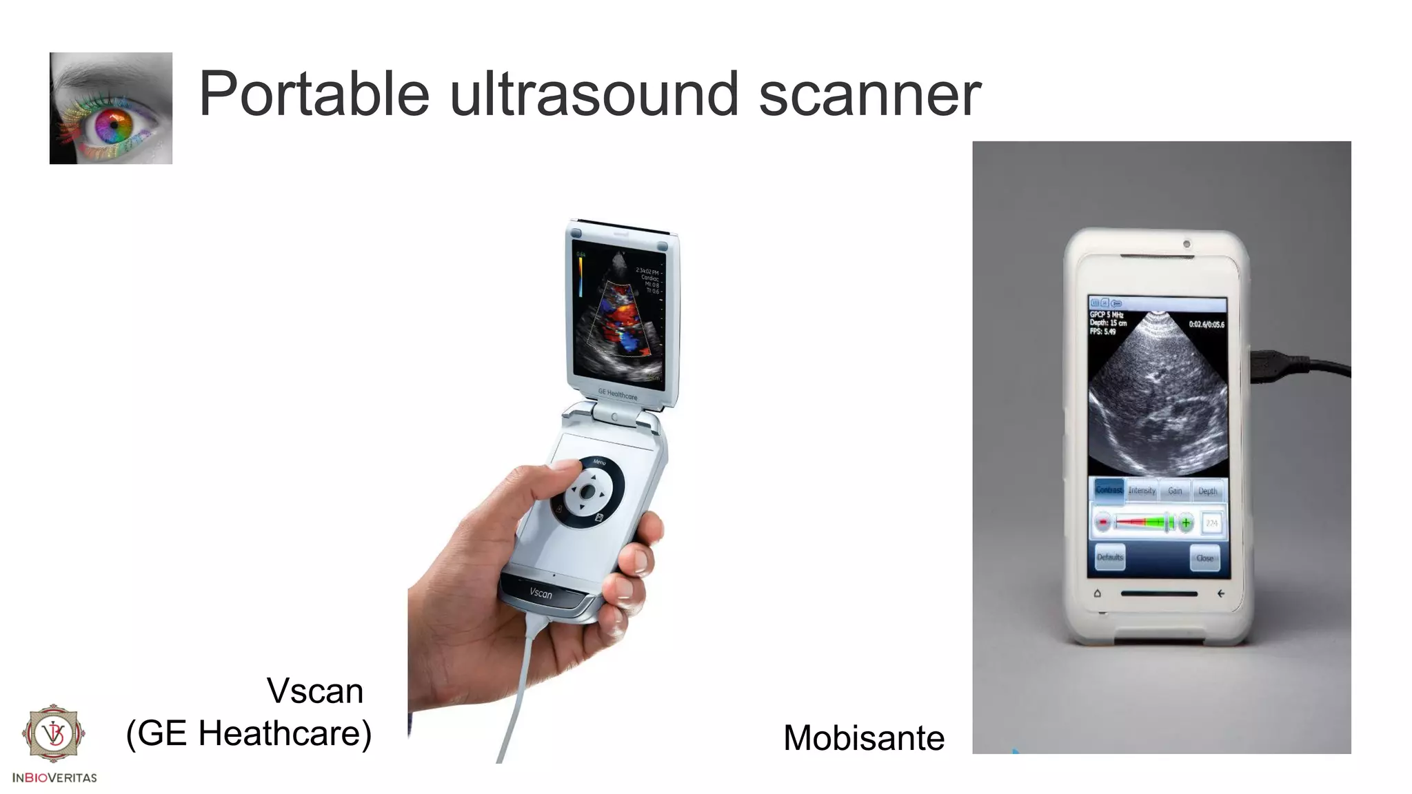Portable ultrasound scanner

Vscan
(GE Heathcare)

Mobisante

 