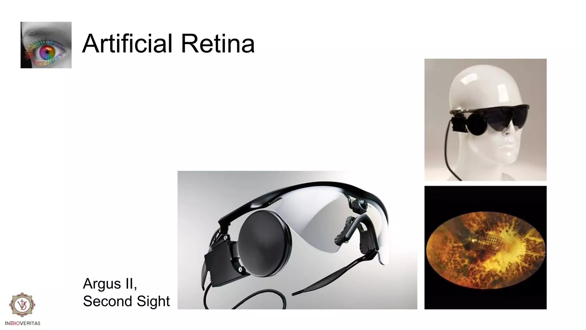 Artificial Retina

Argus II,
Second Sight

 