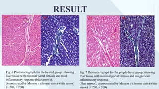 RESULT
Fig. 6 Photomicrograph for the treated group: showing
liver tissue with minimal portal fibrosis and mild
inflammatory response (blue arrows),
demonstrated by Masson trichrome stain (white arrow)
(× 200, × 200)
Fig. 7 Photomicrograph for the prophylactic group: showing
liver tissue with minimal portal fibrosis and insignificant
inflammatory response
(blue arrows), demonstrated by Masson trichrome stain (white
arrow) (× 200, × 200)
 
