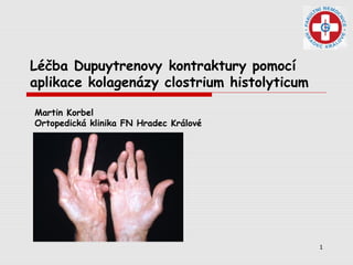 1
Léčba Dupuytrenovy kontraktury pomocí
aplikace kolagenázy clostrium histolyticum
Martin Korbel
Ortopedická klinika FN Hradec Králové
 