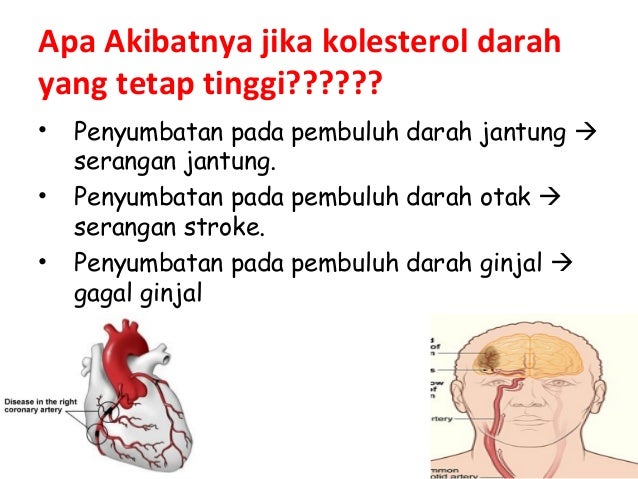 KOLESTEROL KOLESTEROL