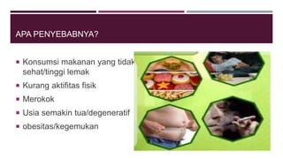 APA PENYEBABNYA?
 Konsumsi makanan yang tidak
sehat/tinggi lemak
 Kurang aktifitas fisik
 Merokok
 Usia semakin tua/degeneratif
 obesitas/kegemukan
 