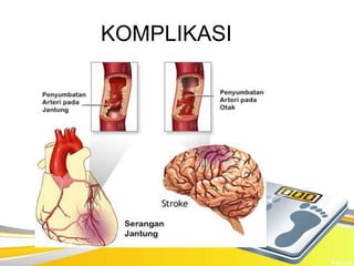 KOMPLIKASI
 
