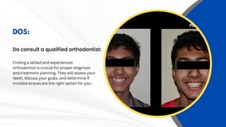 Kolkata Smile Secrets Dos & Don'ts of Invisible Braces | PPT