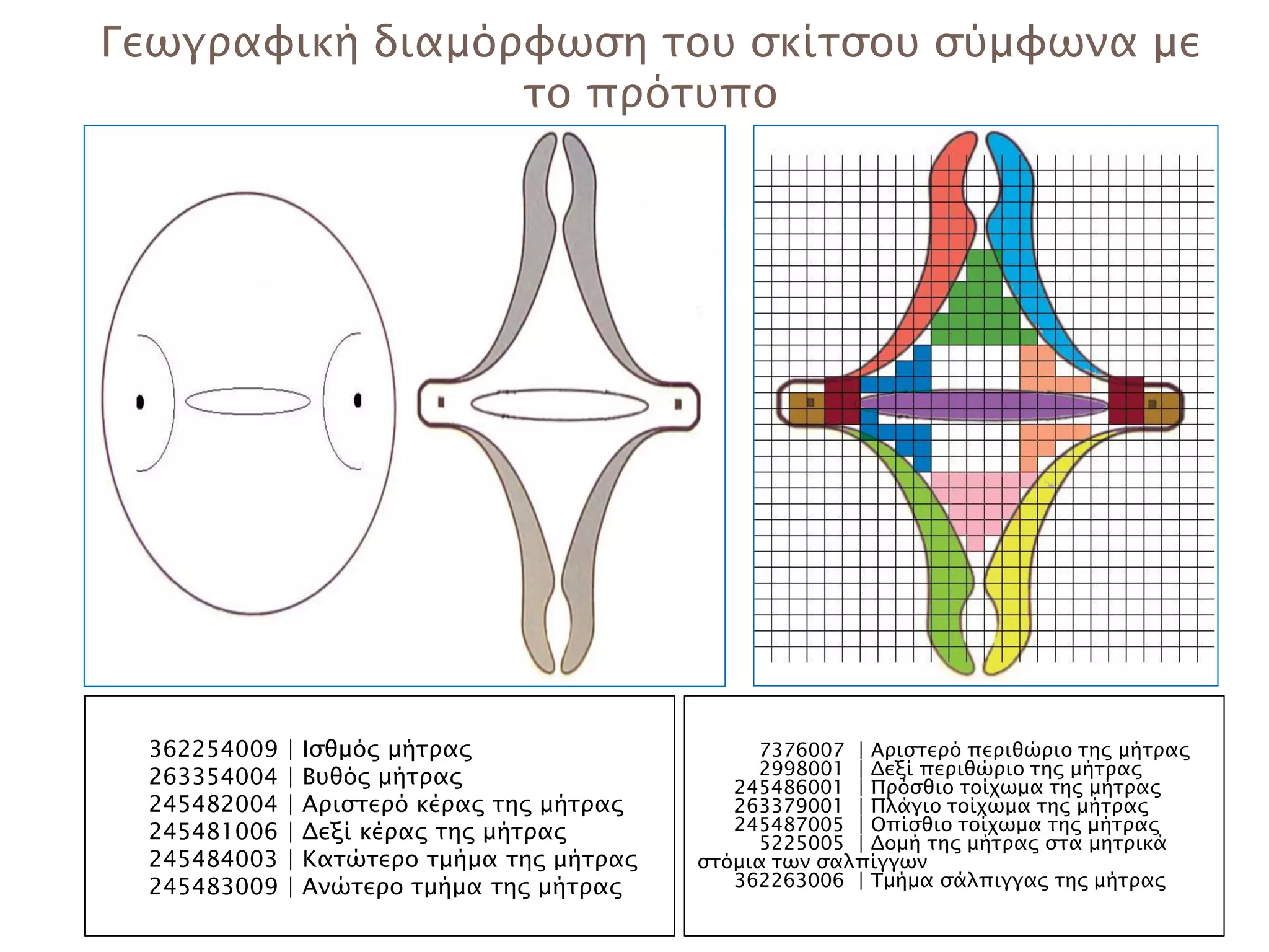 Γεωγραφική διαμόρφωση του σκίτσου σύμφωνα με
                 το πρότυπο




 362254009   |   Ισθμός μήτρας                    7376007 | Αριστερό περιθώριο της μήτρας
 263354004   |   Βυθός μήτρας                     2998001 | Δεξί περιθώριο της μήτρας
                                                245486001 | Πρόσθιο τοίχωμα της μήτρας
 245482004   |   Αριστερό κέρας της μήτρας      263379001 | Πλάγιο τοίχωμα της μήτρας
 245481006   |   Δεξί κέρας της μήτρας          245487005 | Οπίσθιο τοίχωμα της μήτρας
                                                  5225005 | Δομή της μήτρας στα μητρικά
 245484003   |   Κατώτερο τμήμα της μήτρας   στόμια των σαλπίγγων
 245483009   |   Ανώτερο τμήμα της μήτρας       362263006 | Τμήμα σάλπιγγας της μήτρας
 