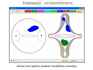 Σκαρίφημα υστεροσκόπησης




Φιλικό στον χρήστη γραφικό περιβάλλον εργασίας
 