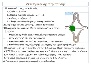 Μελέτη κλινικής περίπτωσης
1.Προσωπικά στοιχεία ασθενούς
     α.Ηλικία : 44 ετών
     β.Στοιχεία έμμηνου κύκλου : 27,4,13
     γ.Αριθμός γεννήσεων :2
     δ.Ένδειξη υστεροσκόπησης : Χρήση Tamoxifen
2.Σκαρίφημα ιατρού μετά την ιατρική διαδικασία
3.Η ανάλυση της εικόνας έδωσε τα παρακάτω αποτε-
    λέσματα :
     1.Μεγαλος αριθμός εικονοστοιχείων με πράσινο χρώμα
      στην αριστερή πλευρά της εικόνας
     2.Εικονοστοιχεία της δεξιάς σάλπιγγας είναι πράσινα
     3.Εικονοστοιχεία της αριστερής σάλπιγγας δεν έχουν χρωματισμό
4.Η ομαδοποίηση και η εκκαθάριση των δεδομένων έδωσε τελικά τα ακόλουθα
Α.87,2 % των εικονοστοιχείων του αριστερού κέρατος της μήτρας είναι πράσινα
Β.44 % των εικονοστοιχείων του βυθού της μήτρας είναι πράσινα
Γ. Το δεξιό σαλπιγγικό στόμιο ανοιχτό , ενώ το δεξί κλειστό.
Δ. Το πράσινο χρώμα αντιστοιχεί σε «πολύποδα»
 