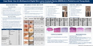 Case Study: Use of a Multispectral Digital Skin Lesion Analysis Device (MSDSLA) in Pediatrics and Young Adults
Marcella Kollmann, MD
BACKGROUND

C A S E S T U D I E S – Y O U N G A D U LT S

READER STUDY REVIEW

Introduction
 Differentiation of early melanomas from benign lesions in young adults
(16 – 25) can be difficult clinically
 Incidence of melanoma in children and adolescents has increased at an
annual rate of 2.0% per year from 1973 to 20091
 Biopsy ratio of up to 80 to 1 have been observed in younger patients2
 Melanoma is the most common cancer in young adults aged 20 to 303
 MSDSLA can be used to help dermatologists decide which lesions may
be suspicious for melanoma by providing information about the structure
of a lesion from under the skin (MelaFind; MELA Sciences, Inc.)

 Two reader studies were conducted presenting high resolution images
and case histories for 130 pigmented skin lesions to dermatologists in
the U.S. (n = 110)5 and in Germany5 (n = 101). After reviewing the
case, dermatologists were asked to provide their lesion management
decisions.
 Sensitivity of both U.S. and German dermatologists were 72% and
70%, respectively.
 5 melanomas from young adult patients, all invasive, were randomly
selected for review by these 211 dermatologists (Table 1).

Table 2. Melanomas from young adults on reader studies

Pivotal Study
 The pivotal study for MSDSLA (MelaFind®: Irvington, NY) established
that it was a safe and effective device by demonstrating high sensitivity to
melanoma (98.3%) and better specificity than study clinicians (9.9% vs.
3.7%, p = 0.02)4

 In the pivotal study, 183 lesions from young adult patients aged 16 to 25
were enrolled; of these, 13 were melanomas or high grade lesions, 11 of
which were correctly considered MSDSLA “High Disorganization”

Clinical

Dermoscopic

% of
Breslow Patient dermatologists
(mm)
Age
electing NOT
to biopsy

MSDSLA
Dermoscopic
Image

CASE STUDY # 1:
 17 year old female; regular skin visits

CASE STUDY # 2:
 24 year old male
 Lesion appeared within 4 months of
excision and grew within that time

 > 50 nevi (none dysplastic)

 No family history of melanoma
 Fitzpatrick Skin Type II-III

Lesion Location

 No risk factors for melanoma
 Clinical diagnosis: Spitz/Reed Nevus

 Lesion clinically unsuspicious over 3 yrs

MSDSLA
Dermoscopic
Image

Lesion Location

 MSDSLA score: 3.3

 MSDSLA score: 3.5

 Pathology: melanoma in situ

 Pathology: melanoma in situ
MSDSLA Multispectral Images:

MSDSLA Multispectral Images:

430 nm
24

500 nm

510 nm

600 nm

430 nm

460 nm

500 nm

510 nm

600 nm

660 nm

0.32

460 nm

700 nm

780 nm

880 nm

950 nm

660 nm

700 nm

780 nm

880 nm

950 nm

1.9%

 Of the 11 melanomas enrolled from young adults, all were invasive,
except one melanoma in situ, with median Breslow thickness of 0.50 mm
 A total of 136 young adults were enrolled on the pivotal study; none had a
history of pigmented basal or squamous cell carcinoma. Table 1 shows
characteristics of these young adults

0.17

24

48.6%

0.60

18

57.3%

0.70

17

46.0%

Histology:

Histology:

Table 1. Characteristics of Young Adults (pivotal study)
Baseline Characteristics
Female
Male
Asian or Pacific Highlander
RACE
White
Other
Mean
AGE
Median
Standard Deviation
I
II
FITZPATRICK SKIN TYPE
III
IV
HISTORY OF DYSPLASTIC NEVI*
HISTORY OF MELANOMA
FAMILY HISTORY OF MELANOMA**
BLONDE/RED HAIR
BLUE/GREEN EYES
1-10
11-30
NUMBER OF NEVI
31-50
> 50
Never
1-10 times
USE OF TANNING BED
11-24 times
> 24 times
SEX

% (N = 136)
66.2%
33.8%
3.7%
95.6%
0.7%
21
21
2.8
5.1%
51.5%
36.0%
7.4%
29.0%
7.4%
20.2%
40.4%
63.2%
37.5%
36.8%
13.2%
12.5%
40.4%
23.5%
14.7%
21.3%

CONCLUSIONS

REFERENCES
1 Wong

0.28

25

78.1%

1. Melanomas on young adult patients can be difficult
to detect.
2. MSDSLA can be helpful in assisting in the detection
of early melanomas within young adults, a
population where melanoma incidence is on the rise.

0.15

25

76.2%

JR. Pediatrics. 2013;doi:10.1542/peds.2012-2520
2 English et al. Med J Aust. 2004
3 Masci P, Borden EC. Malignant Melanoma: Treatments Emerging, but early detection is still
key. Cleveland Clinic Journal of Medicine July 2002; Vo. 69 # 7: 529-545.
4

Monheit G, Cognetta AB, Ferris L, et al. The performance of MelaFind: a prospective
multicenter study. Arch Dermatol. 2011;147:188-94.
5 Chen SC, Wells R and Adrian J. (2011, February). Performance of an adjuvant melanoma
detection tool compared to physicians. Poster presented at the American Academy of
Dermatology, New Orleans, LA.
6

Hauschild, Axel. Protocol 20101: To Excise or Not?: Comparing Clinical Management
Decisions for Melanoma Between Dermatologists with and without the Aid of MelaFind.
University of Kiel, Kiel, Germany. Unpublished data; August 2012.

*five values were “unknown”; ** twelve values were “unknown”

Funded in part by a grant from MELA Sciences, Inc.

 