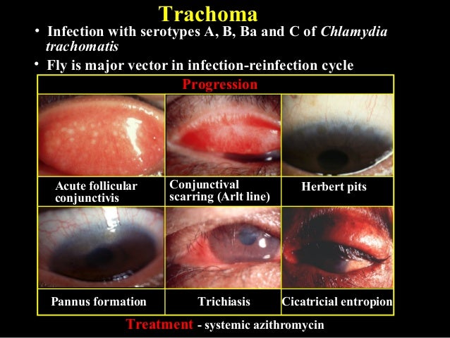 09 conjunctival infections