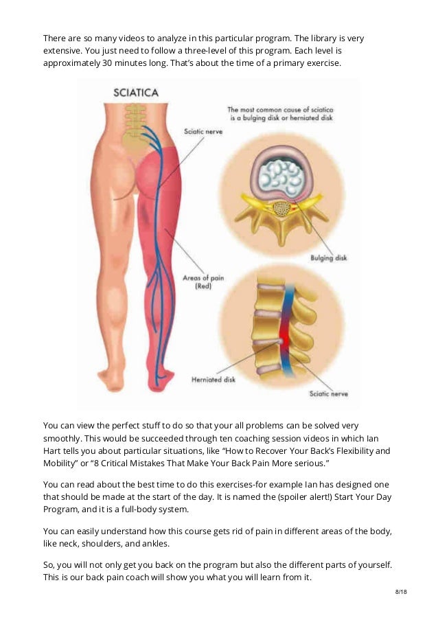 Different Areas Of The Back . Kompasdmc Com My Back Pain Coach Review Is Ian Harts Exercises Scam