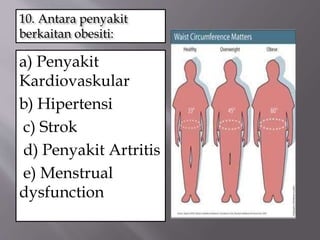 10. Antara penyakit
berkaitan obesiti:
a) Penyakit
Kardiovaskular
b) Hipertensi
c) Strok
d) Penyakit Artritis
e) Menstrual
dysfunction
 
