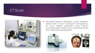 CT Scan
 Teknologi informasi diterapkan pada peralatan
medis misal CT Scan (Computer Tomography).
CT Scan adalah peralatan yang mampu
memotret bagian dalam tubuh seseorang tanpa
harus dilakukan pembedahan.
 
