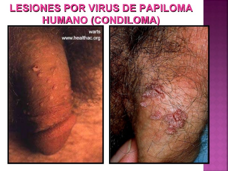 Los aumentos del miembro y cuesta cuanto