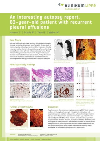 An interesting autopsy report:
83-year-old patient with recurrent
pleural effusions
Hansen T1
| Schulz B1
| Titze U1
| Weber M2
Klinikum Lippe GmbH | Institut für Pathologie1
| Klinik für Pneumologie2
| www.klinikum-lippe.de
Case Study
A 83-year-old female patient was admitted to hospital with increasing
dyspnea, decreasing vigilance and loss of weight in the last couple of
months. Hypothyroidism, hypertension and liver cysts were clinically
known pre-existing disorders. Computed tomography revealed a large
pleural effusion on the right side without evidence of tumor. Pleural
effusion cytology revealed carcinoma cells. The patient developed
fever and presented with clinical signs of sepsis. Finally, she succum-
bed to acute respiratory and renal failure despite intensive care
(including antibiotic therapy) four days after submission to hospital.
Primary Autopsy Findings
Further Critical Results
Computed tomography with extensive
pleural effusion on the right side
Adenocarcinoma of the lung;
TNM-stage (7th ed.): apT4,apN3,apM1b;G3;L1,V1
Molecular pathology applying strip as-
say method1 reveals BRAF V600E mu-
tation in tissue specimens of lung (I)
and colon tumor (II), but not in myo-
cardial tissue (III)
Adenocarcinoma of the coecum
TNM-stage (7th ed.): apT3,apN0,apM0;G2;L0,V0
Macroscopy of the thorax shows
thickening of the right pleura (arrows),
note large liver cysts (*)
Lung
TTF-1
Colon
TTF-1
Colon
cdx2
Discussion
The phenomenon of synchronous neoplasias harboring BRAF V600E mutation
has been previously described only in a few patients, mainly those with
malignant melanoma and hairy cell leukemia2-4. To our knowledge, this is the
first case report of a coexistent adenocarcinoma of the lung and of the colon
both tested positive for BRAF V600E mutation. Since other tissue specimens
analyzed failed to show this mutation, it can be assumed that this finding is not
due to germ cell line mutation, but does reflect a coincident occurence. Besides,
the high number of previously unknown diseases that became evident by the
post-mortem examination of that patient underlines the important role of
autopsies as an instrument of quality assurance and teaching.Recurrent myocardial infarction in the
posterior wall of the left ventricle
Abdominal aortic aneurysm
with dissection (arrow)
References Ausch et al. (2009) J Mol Diagn 11:508
Ghorbani-Aghbolaghi et al. (2017) Autops Case Rep 7:13
Mitsogianni et al. (2018) Case Rep Oncol 11:109
White et al. (2018) Cureus 10:e3600
 