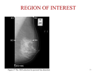 REGION OF INTEREST
• Pectoral muscle would
be present in the top
half of the image.
33Figure 27 The ROI selection for pectoral line detection
 