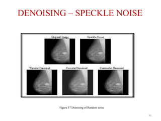 DENOISING – SPECKLE NOISE
45
Figure 37 Denoising of Random noise
 