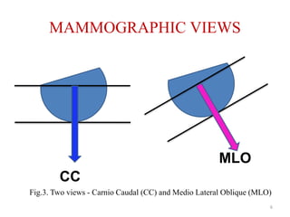 MAMMOGRAPHIC VIEWS
CC
MLO
Fig.3. Two views - Carnio Caudal (CC) and Medio Lateral Oblique (MLO)
6
 