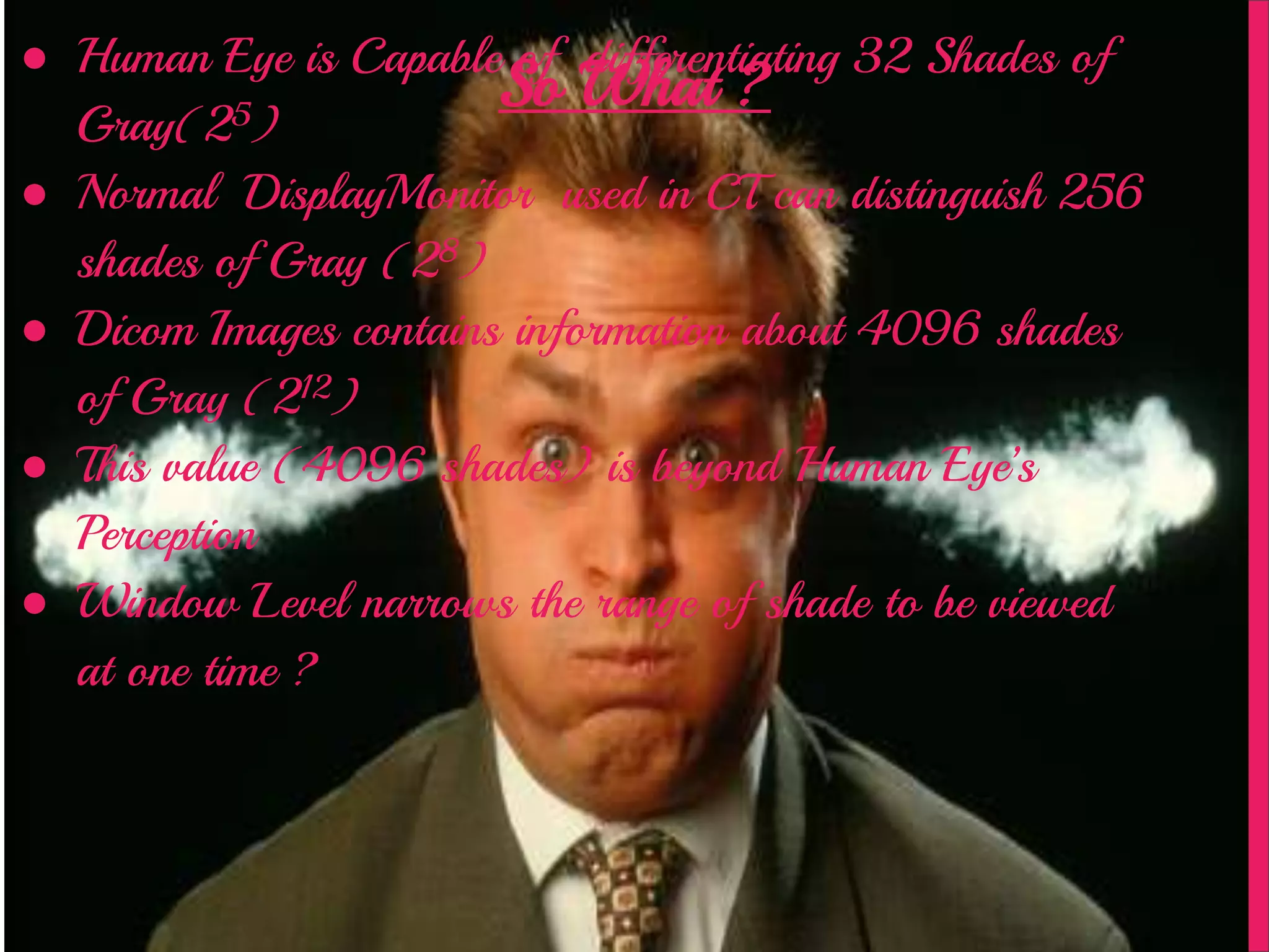 So What ?
● Human Eye is Capable of differentiating 32 Shades of
Gray(25)
● Normal DisplayMonitor used in CT can distinguish 256
shades of Gray (28)
● Dicom Images contains information about 4096 shades
of Gray (212)
● This value (4096 shades) is beyond Human Eye’s
Perception
● Window Level narrows the range of shade to be viewed
at one time ?
 