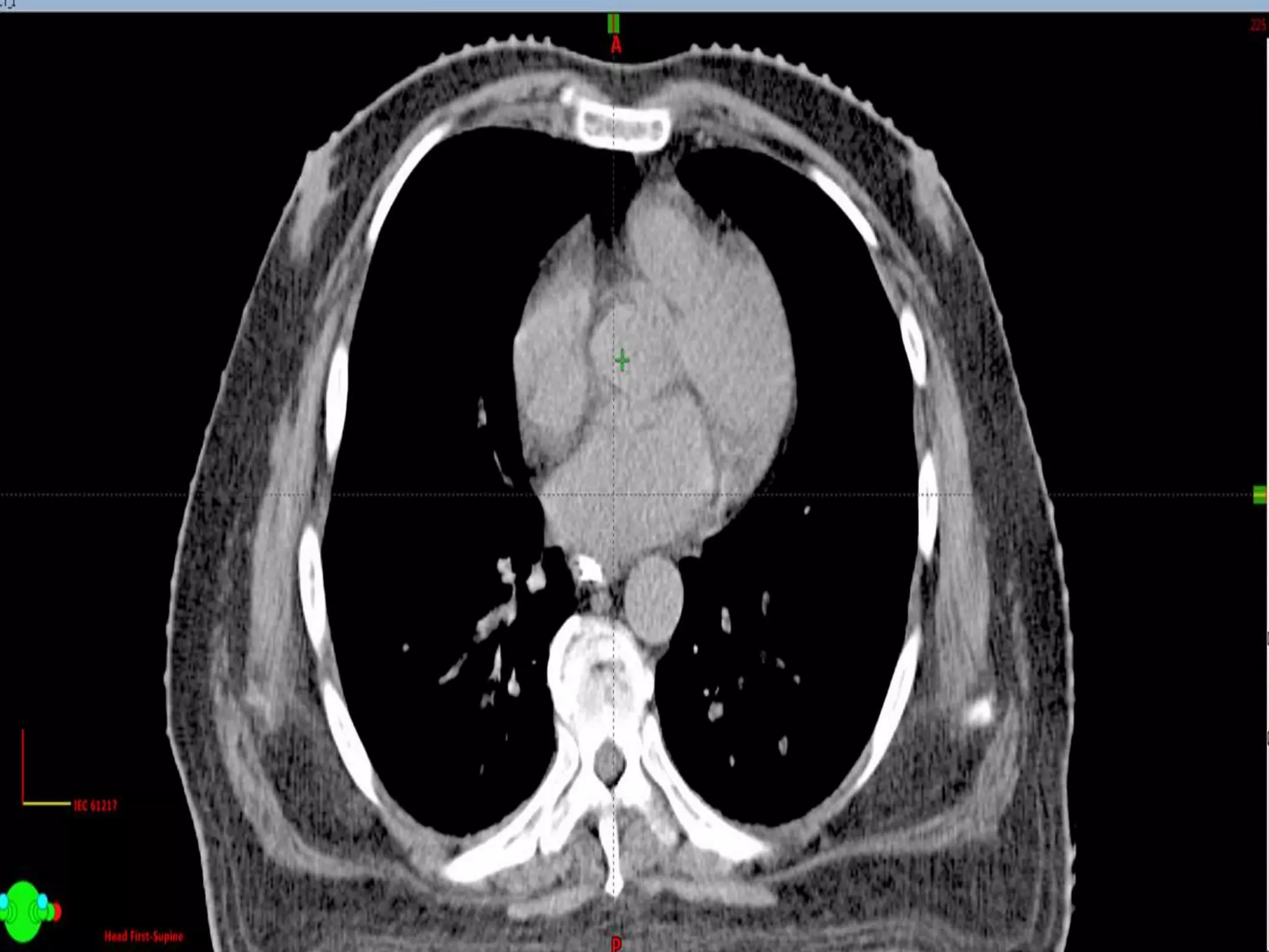 Digital Medical Imaging - Contd...
 