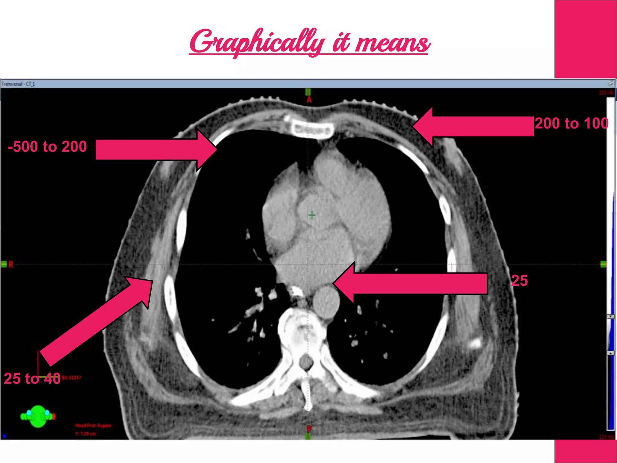 Graphically it means
-500 to 200
-200 to 100
25 to 40
25
 