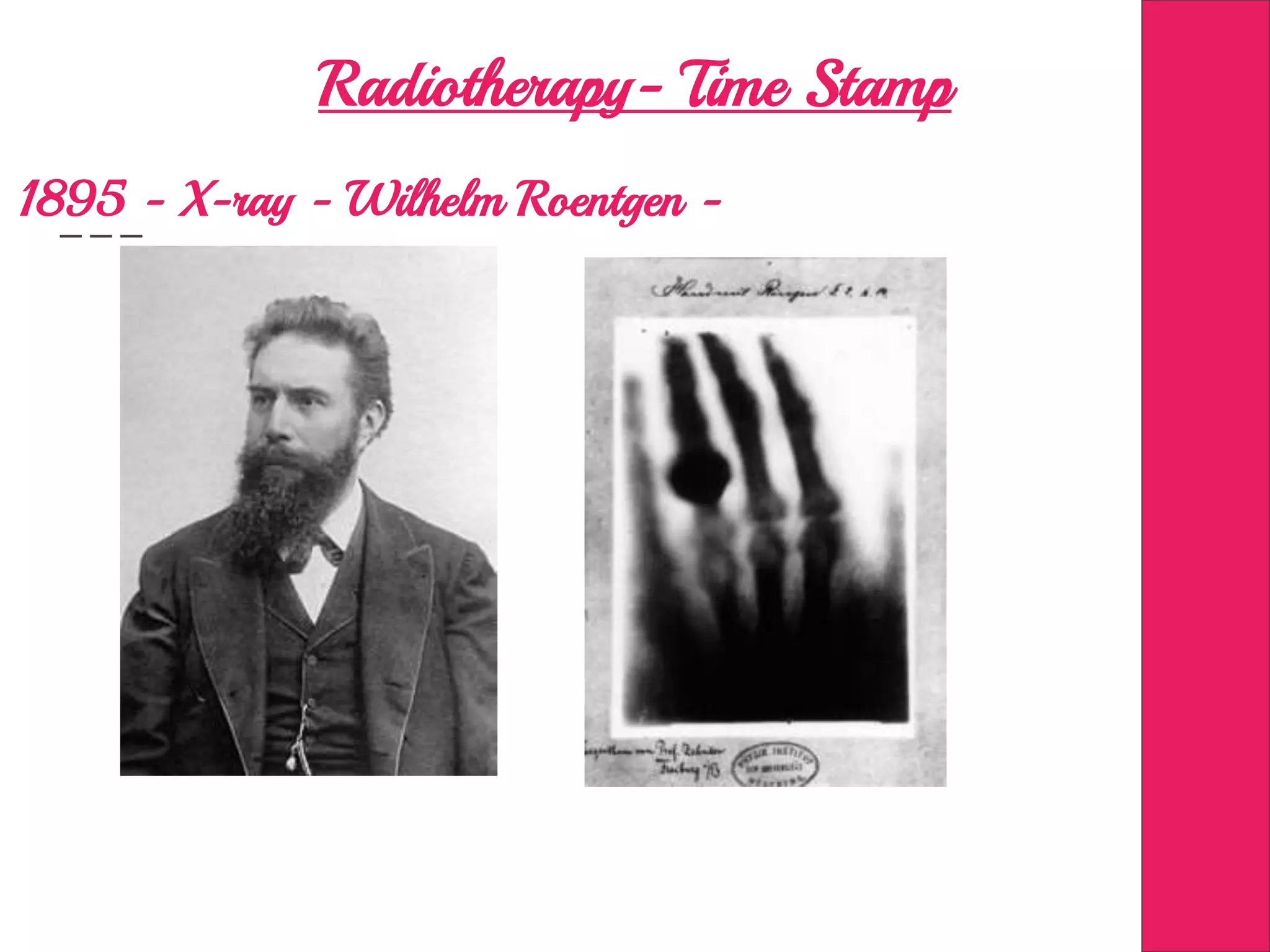 Radiotherapy- Time Stamp
1895 - X-ray - Wilhelm Roentgen -
 