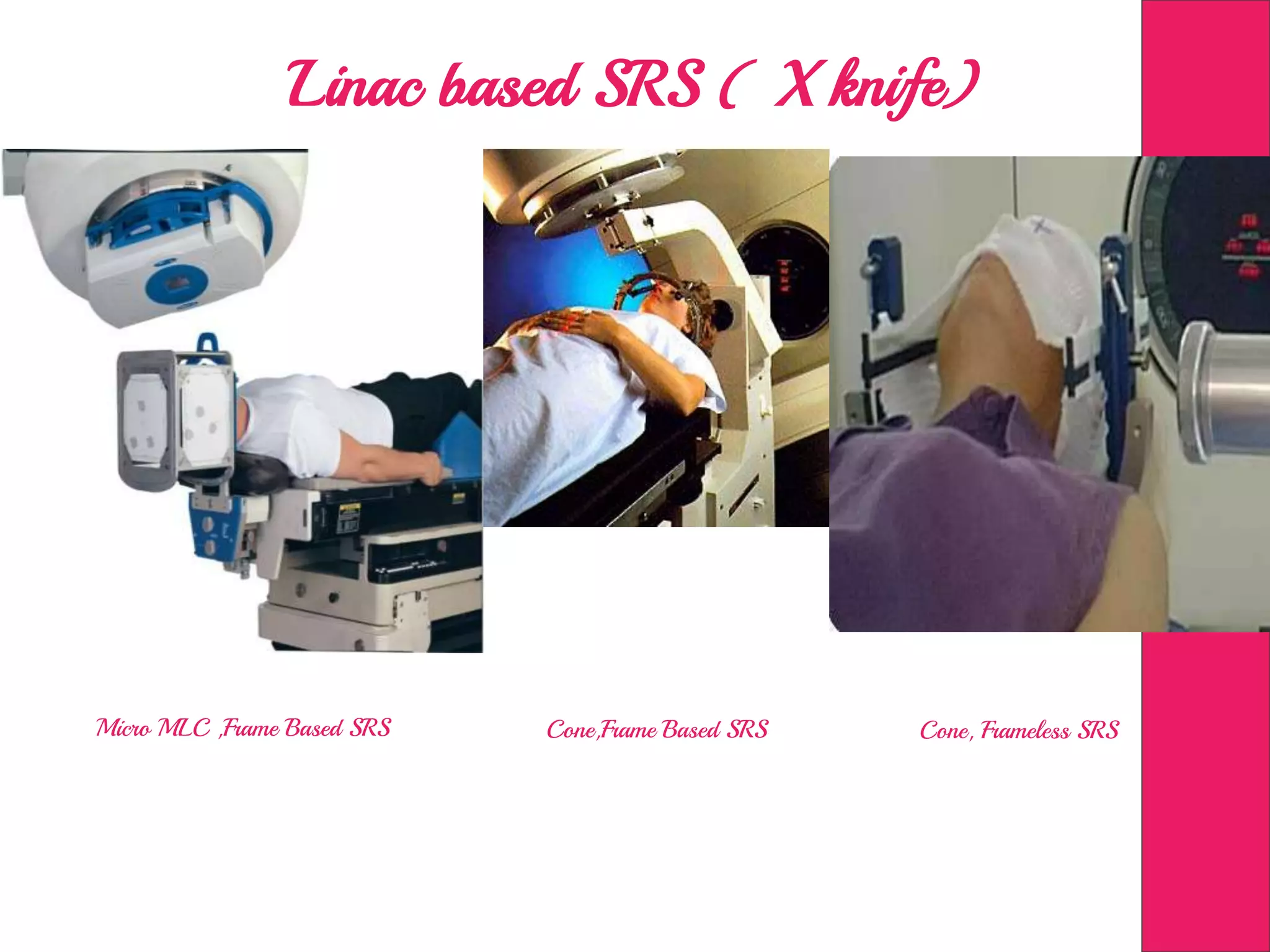 Linac based SRS ( X knife)
Cone, Frameless SRSMicro MLC ,Frame Based SRS Cone,Frame Based SRS
 