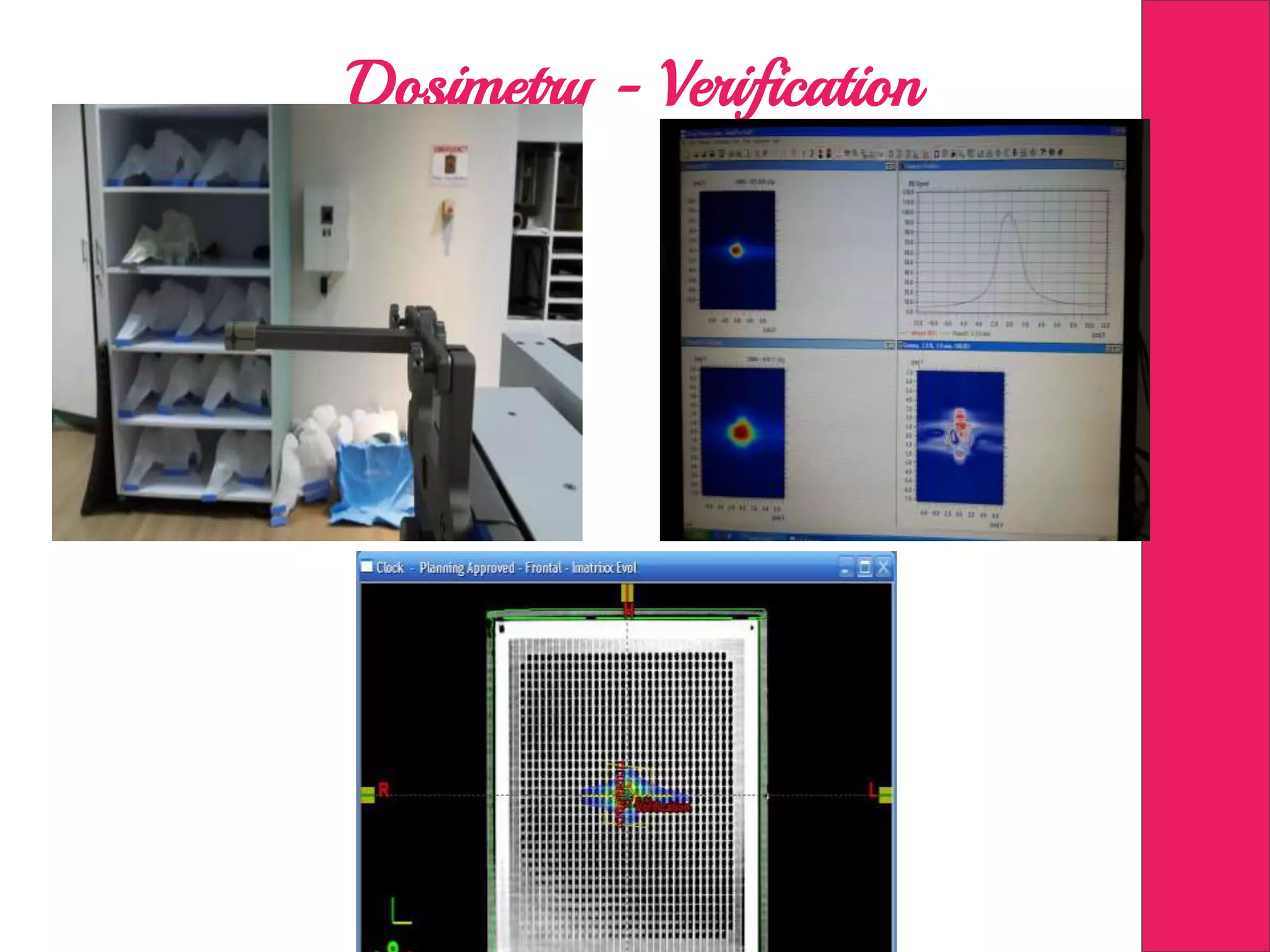 Dosimetry - Verification
 