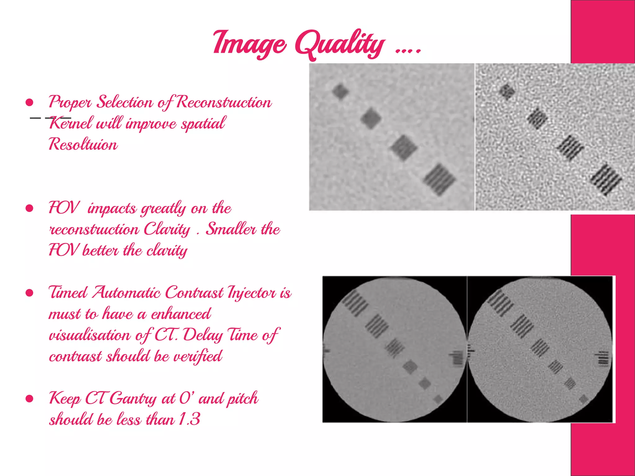 Image Quality ….
● Proper Selection of Reconstruction
Kernel will improve spatial
Resoltuion
● FOV impacts greatly on the
reconstruction Clarity . Smaller the
FOV better the clarity
● Timed Automatic Contrast Injector is
must to have a enhanced
visualisation of CT. Delay Time of
contrast should be verified
● Keep CT Gantry at 0’ and pitch
should be less than 1.3
 