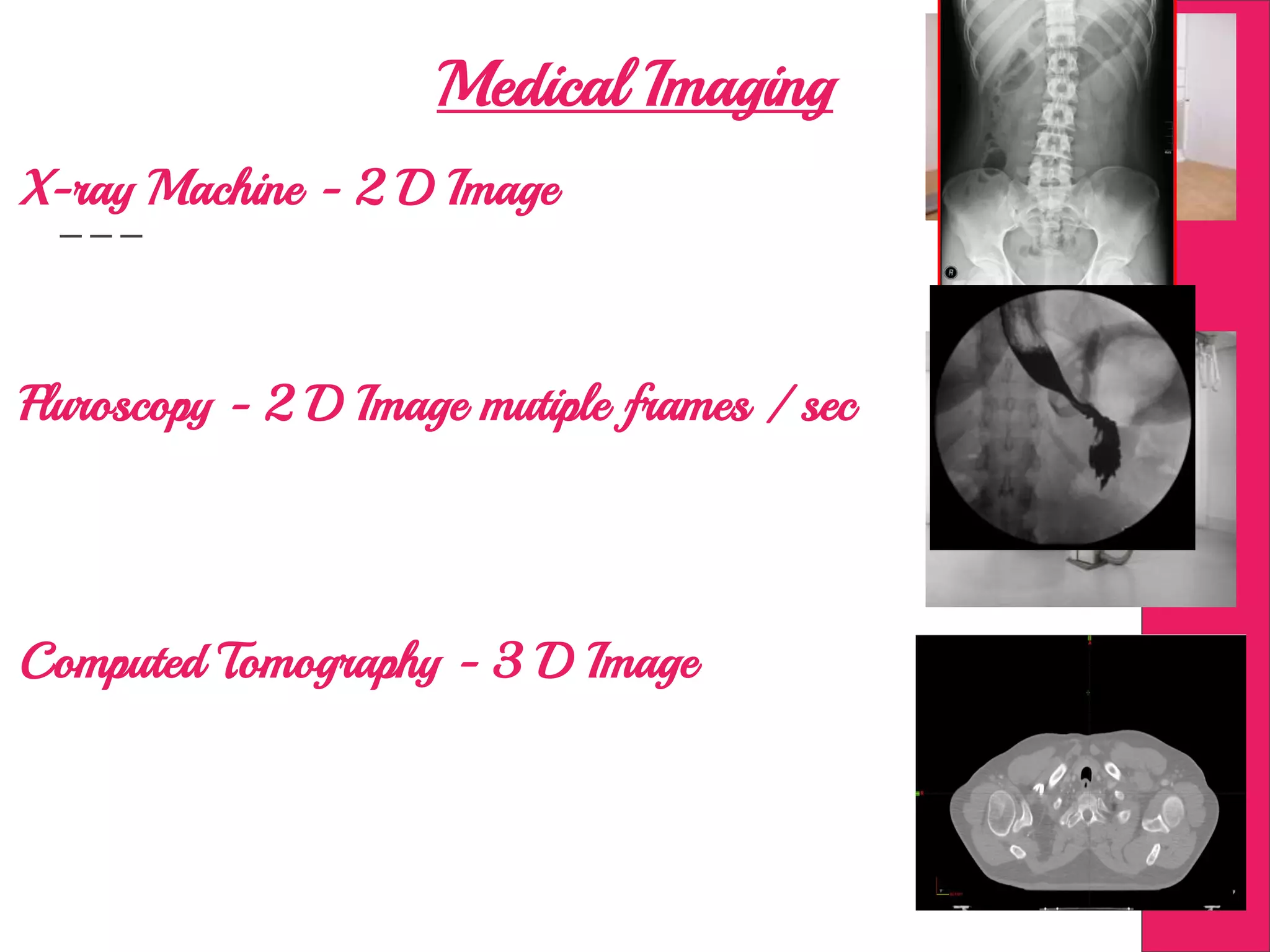 Medical Imaging
X-ray Machine - 2 D Image
Computed Tomography - 3 D Image
Fluroscopy - 2 D Image mutiple frames / sec
 