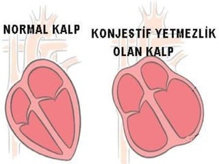 yüksek tansiyon 2 4 yemek kaşığı kediler için kalp sağlığı takviyeleri