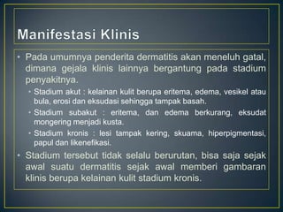 • Pada umumnya penderita dermatitis akan meneluh gatal,
dimana gejala klinis lainnya bergantung pada stadium
penyakitnya.
• Stadium akut : kelainan kulit berupa eritema, edema, vesikel atau
bula, erosi dan eksudasi sehingga tampak basah.
• Stadium subakut : eritema, dan edema berkurang, eksudat
mongering menjadi kusta.
• Stadium kronis : lesi tampak kering, skuama, hiperpigmentasi,
papul dan likenefikasi.

• Stadium tersebut tidak selalu berurutan, bisa saja sejak
awal suatu dermatitis sejak awal memberi gambaran
klinis berupa kelainan kulit stadium kronis.

 