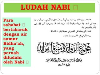 LUDAH NABI 
Para 
sahabat 
bertabaruk 
dengan air 
sumur 
Bidha’ah, 
yang 
pernah 
diludahi 
oleh Nabi 
 
