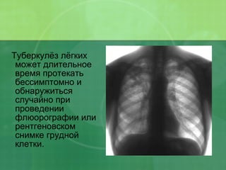 Туберкулёз лёгких может длительное время протекать бессимптомно и обнаружиться случайно при проведении флюорографии или рентгеновском снимке грудной клетки. 