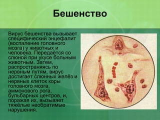 Бешенство Вирус бешенства вызывает специфический энцефалит (воспаление головного мозга) у животных и человека. Передаётся со слюной при укусе больным животным. Затем, распространяясь по нервным путям, вирус достигает слюнных желёз и нервных клеток коры головного мозга, аммонового рога, бульбарных центров, и, поражая их, вызывает тяжёлые необратимые нарушения. 