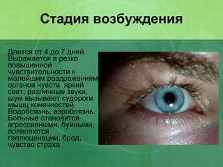 Стадия возбуждения Длится от 4 до 7 дней. Выражается в резко повышенной чувствительности к малейшим раздражениям органов чувств: яркий свет, различные звуки, шум вызывают судороги мышц конечностей. Водобоязнь, аэробоязнь. Больные становятся агрессивными, буйными, появляются галлюцинации, бред, чувство страха. 